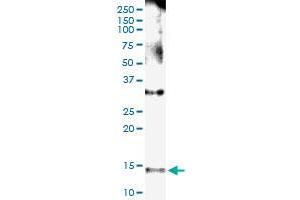 Immunoprecipitation of NPHP1 transfected lysate using anti-NPHP1 MaxPab rabbit polyclonal antibody and Protein A Magnetic Bead , and immunoblotted with NPHP1 MaxPab mouse polyclonal antibody (B01) . (NPHP1 抗体  (AA 1-121))