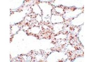 Immunohistochemistry (IHC) image for anti-Zinc Finger and SCAN Domain Containing 4 (ZSCAN4) (C-Term) antibody (ABIN1030831) (ZSCAN4 抗体  (C-Term))