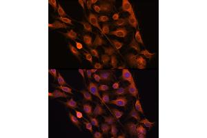 Immunofluorescence analysis of C6 cells using RNH1 Rabbit pAb (ABIN1682553, ABIN3018507, ABIN3018508 and ABIN6220489) at dilution of 100 (40x lens). (RNH1 抗体  (AA 202-461))
