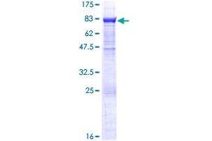 EPHX2 Protein (AA 1-555) (GST tag)