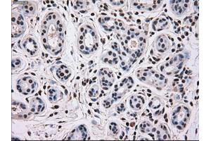 Immunohistochemical staining of paraffin-embedded breast tissue using anti-MAPK12 mouse monoclonal antibody. (MAPK12 抗体)