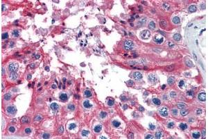 Immunohistochemistry (Formalin-fixed Paraffin-embedded Sections) (IHC (fp)) image for anti-Tubulin, alpha 4a (TUBA4A) (AA 1-449) antibody (ABIN574477)