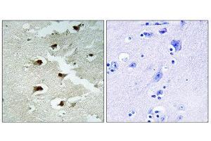 Immunohistochemistry (IHC) image for anti-Cell Division Cycle Associated 4 (CDCA4) (Internal Region) antibody (ABIN1850258)