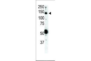 Western blot analysis of anti-Ret Pab (ABIN392038 and ABIN2841806) in SKBR3 cell lysate. (Ret Proto-Oncogene 抗体  (N-Term))