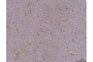 IHC analysis of ADAM22 using anti-ADAM22 antibody (ABIN7600714).