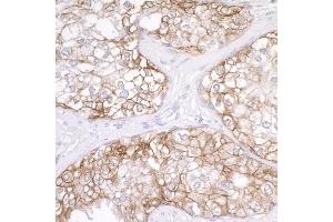 Immunohistochemistry (IHC) image for anti-CD276 (CD276) (AA 484-534) antibody (ABIN7453930)