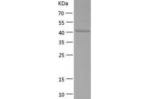 SYT4 Protein (AA 38-425) (His tag)