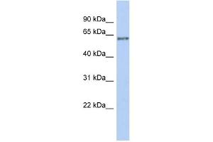 WB Suggested Anti-PCCB Antibody Titration: 0. (PCCB 抗体  (Middle Region))