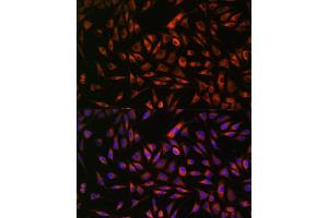 Immunofluorescence analysis of L929 cells using EML4 antibody (ABIN7266891) at dilution of 1:100. (EML4 抗体  (AA 360-560))