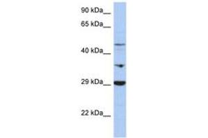 Image no. 1 for anti-Pyruvate Dehydrogenase Kinase, Isozyme 3 (PDK3) (C-Term) antibody (ABIN6743407) (PDK3 抗体  (C-Term))