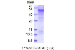 SDS-PAGE (SDS) image for Sprouty-Related, EVH1 Domain Containing 1 (SPRED1) (AA 1-444) protein (His tag) (ABIN7280801)