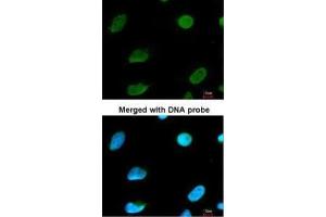 ICC/IF Image Immunofluorescence analysis of paraformaldehyde-fixed HeLa, using CBFA2T2, antibody at 1:200 dilution.