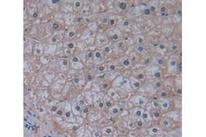 IHC-P analysis of liver tissue, with DAB staining. (MARS 抗体  (AA 74-198))