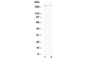 Western blot testing of human 1) HeLa and 2) A549 cell lysate with ABCC1 antibody at 0. (ABCC1 抗体  (AA 1493-1528))