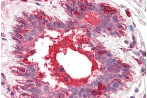 Human Breast (formalin-fixed, paraffin-embedded) stained with HGF antibody ABIN461958 at 10 ug/ml followed by biotinylated anti-mouse IgG secondary antibody ABIN481714, alkaline phosphatase-streptavidin and chromogen. (HGF 抗体)