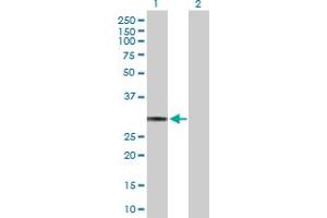 Western Blot analysis of HLA-DQA1 expression in transfected 293T cell line by HLA-DQA1 MaxPab polyclonal antibody.