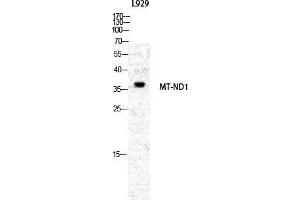 Western Blot (WB) analysis of specific cells using ND1 Polyclonal Antibody.