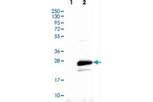 Western blot analysis of Lane 1: Negative control (vector only transfected HEK293T lysate), Lane 2: Over-expression Lysate (Co-expressed with a C-terminal myc-DDK tag (~3. (CMTM6 抗体)