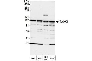 anti-TAO Kinase 1 (TAOK1) (AA 400-450) antibody