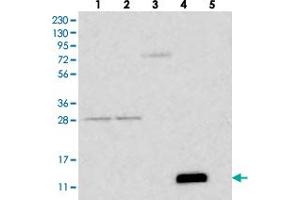 Western blot analysis of Lane 1: RT-4, Lane 2: U-251 MG, Lane 3: Human Plasma, Lane 4: Liver, Lane 5: Tonsil with FCER1G polyclonal antibody . (FCER1G 抗体)