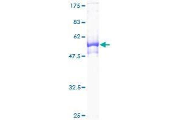 WDR61 Protein (AA 1-305) (GST tag)