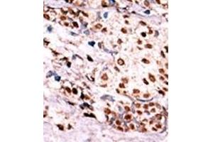 Image no. 2 for anti-Met Proto-Oncogene (MET) (pTyr1349) antibody (ABIN358164)
