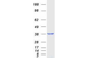 Western Blotting (WB) image for Musashi Homolog 2 (MSI2) (Transcript Variant 1) protein (Myc-DYKDDDDK Tag) (ABIN2726602)