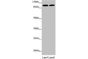 Western blot All lanes: PDE6A antibody at 3. (PDE6A 抗体  (AA 656-860))
