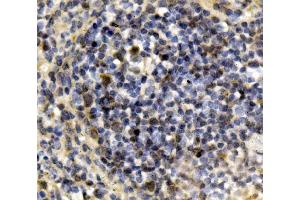 IHC analysis of IRF3 using anti-IRF3 antibody (ABIN7599373).