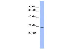 Western Blotting (WB) image for anti-Proteasome (Prosome, Macropain) Subunit, beta Type 10 (PSMB10) (Middle Region) antibody (ABIN2786722)