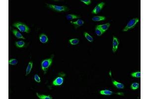 Immunofluorescence (IF) image for anti-Solute Carrier Family 5 (Sodium/glucose Cotransporter), Member 1 (SLC5A1) (AA 239-288) antibody (ABIN7170019)