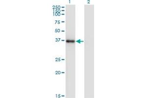 Western Blot analysis of NKX2-5 expression in transfected 293T cell line by NKX2-5 monoclonal antibody (M04), clone 3C1. (NK2 Homeobox 5 抗体  (AA 1-130))