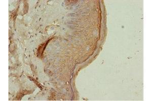 Immunohistochemistry of paraffin-embedded human skin tissue using ABIN7144821 at dilution of 1:100 (ATM Interactor 抗体  (AA 160-360))