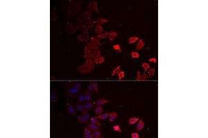 Immunofluorescence analysis of MCF7 cells using P2RX4 Polyclonal Antibody (P2RX4 抗体)