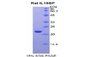 SDS-PAGE analysis of Rat IL18BP Protein. (IL18BP 蛋白)