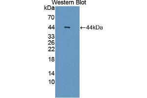 Detection of Recombinant AIM2, Human using Polyclonal Antibody to Absent In Melanoma 2 (AIM2) (AIM2 抗体  (AA 1-343))