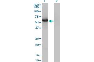 Western Blot analysis of GIT2 expression in transfected 293T cell line by GIT2 monoclonal antibody (M01), clone 3B5-B9.