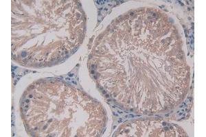 Used in DAB staining on fromalin fixed paraffin- embedded stomach tissue (GAS6 抗体  (AA 100-312))