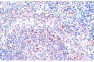 Immunohistochemistry of paraffin-embedded Mouse spleen using P90RSK Polyclonal Antibody at dilution of 1:100 (40x lens). (RPS6KA3 抗体)