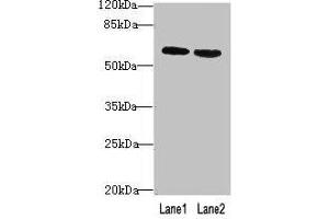 Western blot All lanes: BTN2A2 antibody at 10 μg/mL Lane 1: MCF-7 whole cell lysate Lane 2: NIH/3T3 whole cell lysate Secondary Goat polyclonal to rabbit IgG at 1/10000 dilution Predicted band size: 60, 38, 29, 46, 36 kDa Observed band size: 60 kDa (BTN2A2 抗体  (AA 33-262))