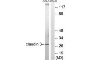 Western blot analysis of extracts from COLO205 cells, treated with EGF 200ng/ml 30', using Claudin 3 (Ab-219) Antibody. (Claudin 3 抗体  (AA 171-220))