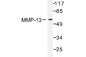 Image no. 1 for anti-Matrix Metallopeptidase 13 (Collagenase 3) (MMP13) antibody (ABIN265524) (MMP13 抗体)