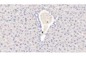 Detection of CRP in Mouse Liver Tissue using Polyclonal Antibody to C Reactive Protein (CRP) (CRP 抗体  (AA 20-225))