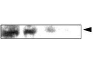 Western Blotting (WB) image for anti-Crystallin, alpha A (CRYAA) antibody (ABIN6245676) (CRYAA 抗体)