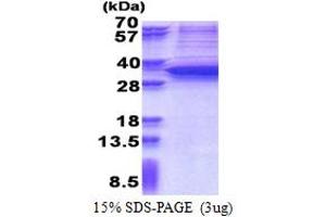 SDS-PAGE (SDS) image for SNAIL (SNAI1) (AA 1-264) protein (His tag) (ABIN5853351) (SNAIL Protein (SNAI1) (AA 1-264) (His tag))