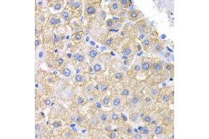 Immunohistochemistry (IHC) image for anti-V-Crk Sarcoma Virus CT10 Oncogene Homolog (Avian) (CRK) (AA 1-304) antibody (ABIN3015531) (Crk 抗体  (AA 1-304))