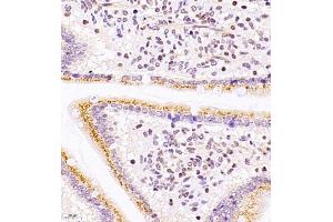 Immunohistochemistry of paraffin embedded mouse duodenum using ASBT (ABIN7075648) at dilution of 1:1500 (400x lens) (SLC10A2 抗体)