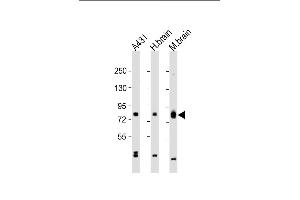 All lanes : Anti-PKC beta1/2 Antibody (Center) at 1:2000 dilution Lane 1: A431 whole cell lysate Lane 2: human brain lysate Lane 3: mouse brain lysate Lysates/proteins at 20 μg per lane. (PKC beta1/2 (AA 303-334) 抗体)
