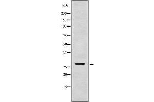 Western blot analysis of TGIF2LX using HepG2 whole cell lysates (TGIF2LX 抗体)