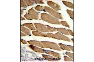 Formalin-fixed and paraffin-embedded human skeletal muscle reacted with ACTR2 Antibody (Center), which was peroxidase-conjugated to the secondary antibody, followed by DAB staining. (ACTR2 抗体  (AA 191-219))